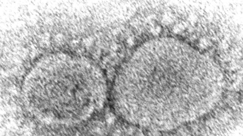 ARCHIVO - Esta imagen de microscopio de 2020 proporcionada por los Centros para el Control y...
